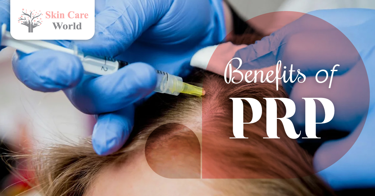 Benefits Of PRP